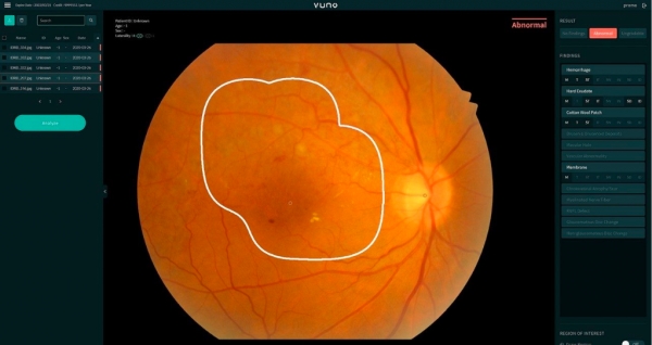 AI 헬스케어 솔루션 기업 '뷰노'의 뷰노메드 펀더스 AI 솔루션 [사진=엔비디아]